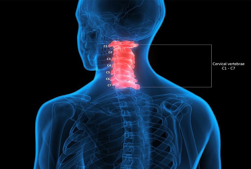 fracture-dislocation-of-vertebra-dr-sandip-mavani